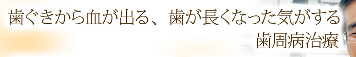 歯ぐきから血が出る、歯が長くなった気がする　歯周病治療
